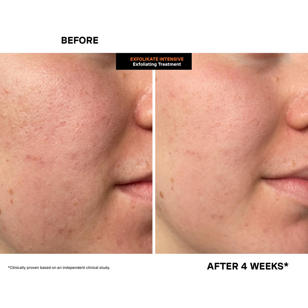 Kate Somerville ingredient label highlighting acids and enzymes benefit