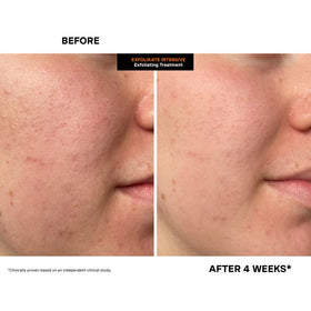 Kate Somerville ingredients flatlay showing acids and fruit enzymes for resurfacing benefits