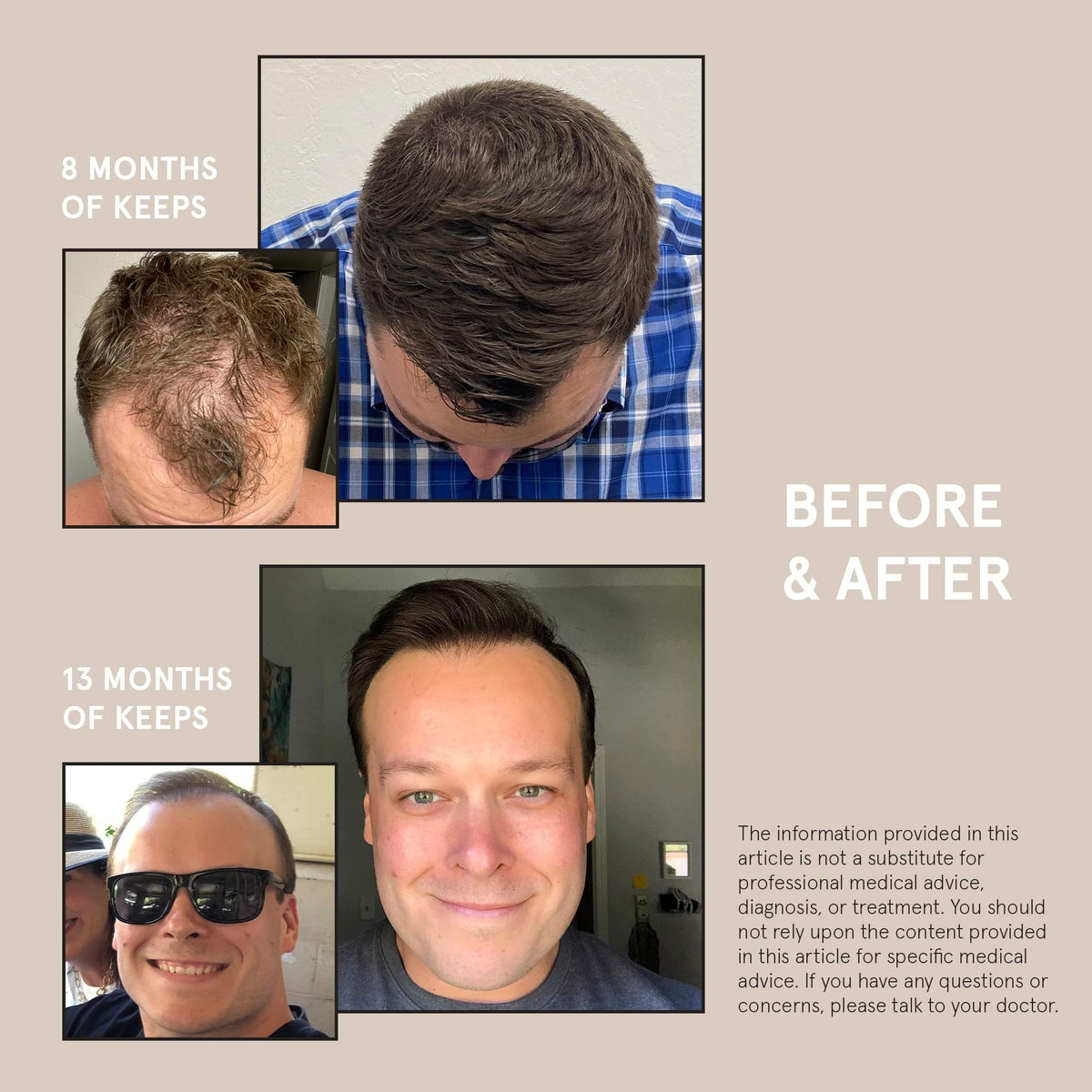 Keeps before and after styling comparison showing fuller-looking hair benefit