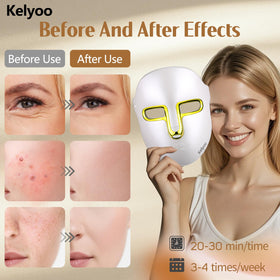 Kelyoo close-up of 119 LED bulbs, demonstrating targeted light coverage benefit