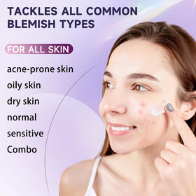 Kempc 1.7 oz tube beside common items to show compact travel-friendly size benefit