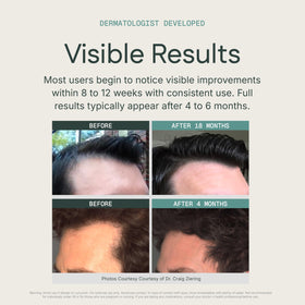 KeraFactor styled hair before and after for fuller looking hair appearance