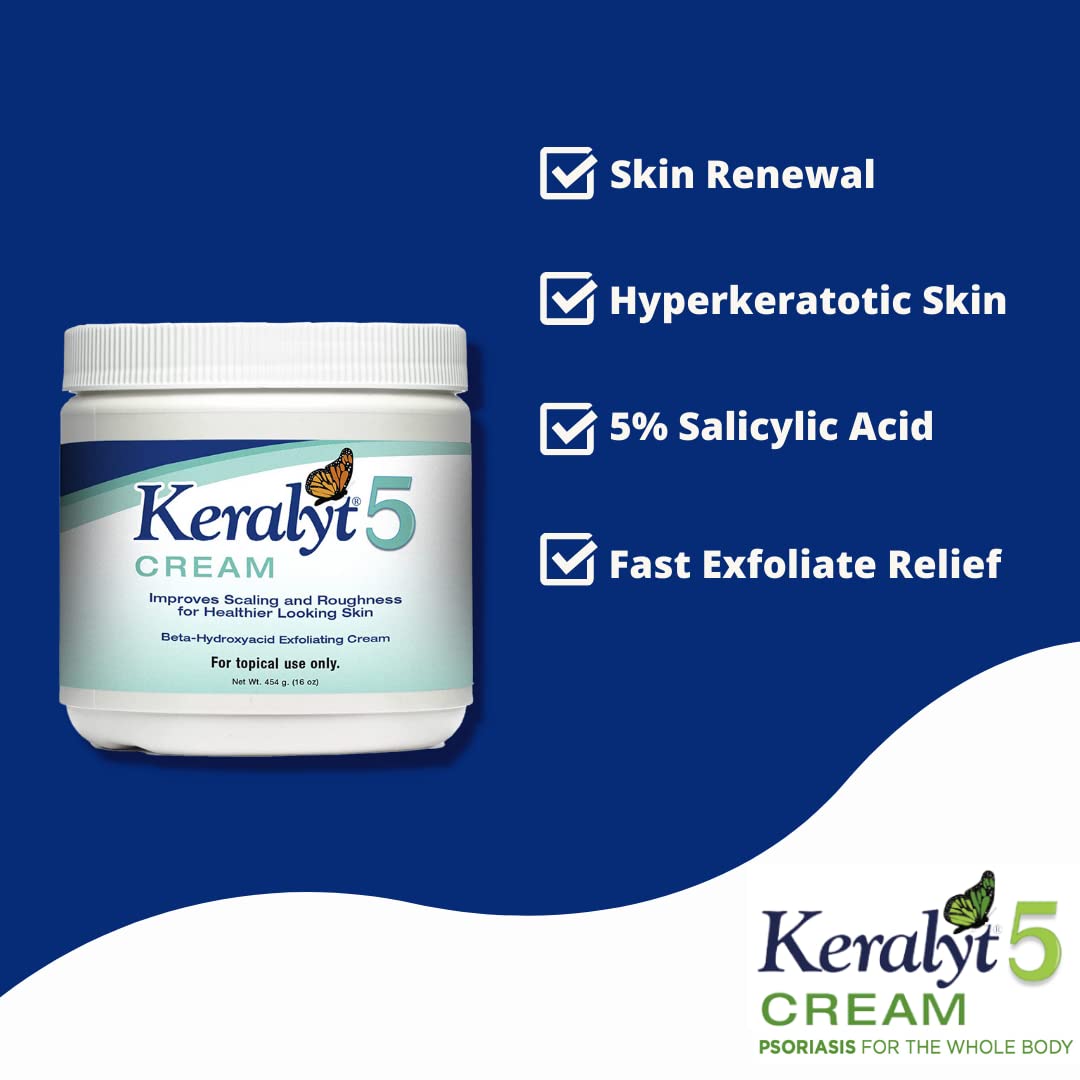 Keralyt 5 cream on hand closeup demonstrating easy spread and softening benefit