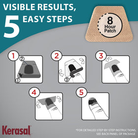 Kerasal patch applied to a toenail demonstrating protective, cosmetic improvement