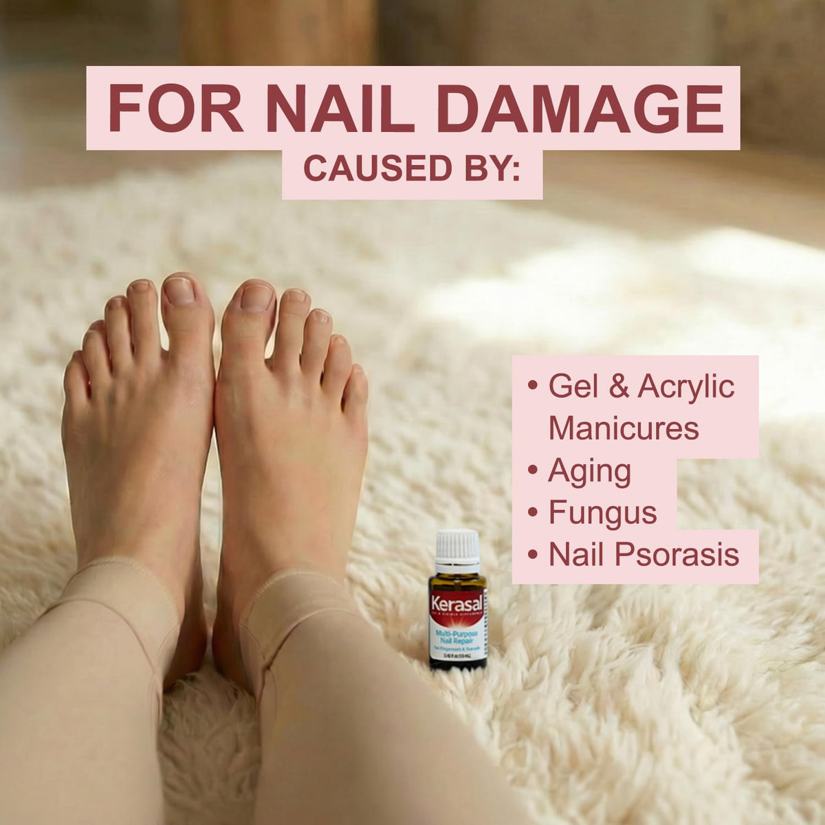 Kerasal before and after nails illustrating improved appearance and smoothing