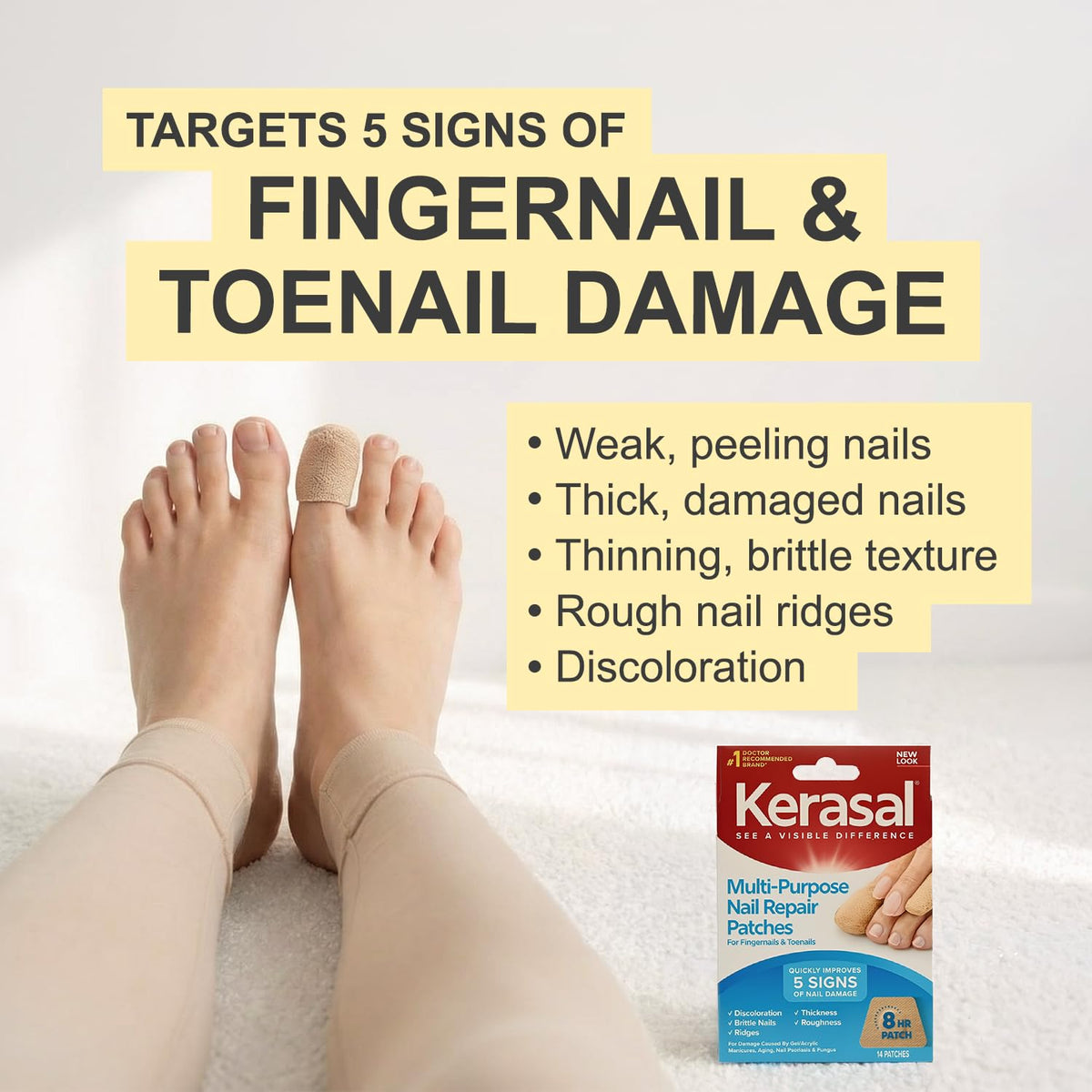 Kerasal patch applied on fingernail demonstrating improved appearance and protection