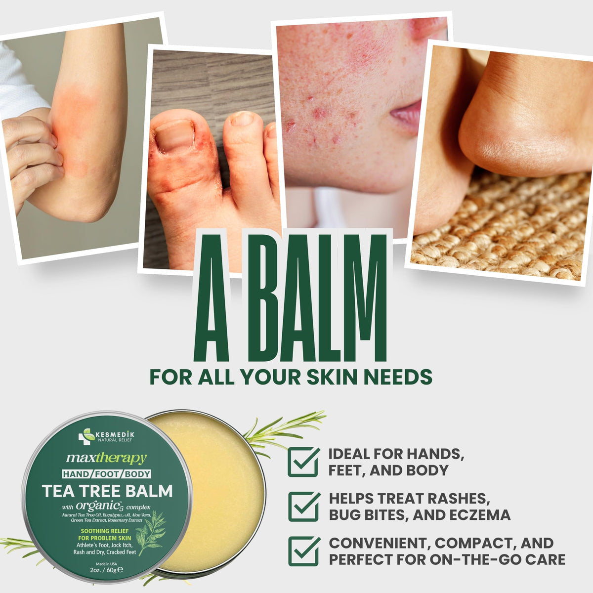 KESMEDIK applying balm to foot to soothe athlete’s foot and discomfort