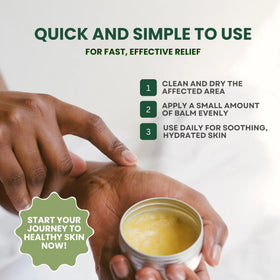 KESMEDIK balm next to aloe vera and beeswax showing natural ingredients