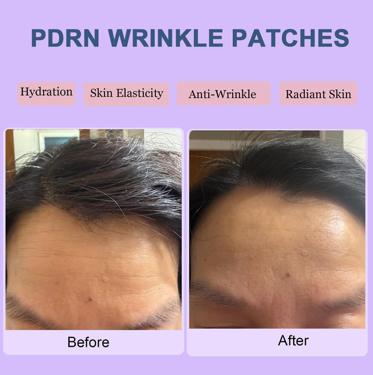 Kewhunt patch applied on forehead demonstrating overnight smoothing benefit