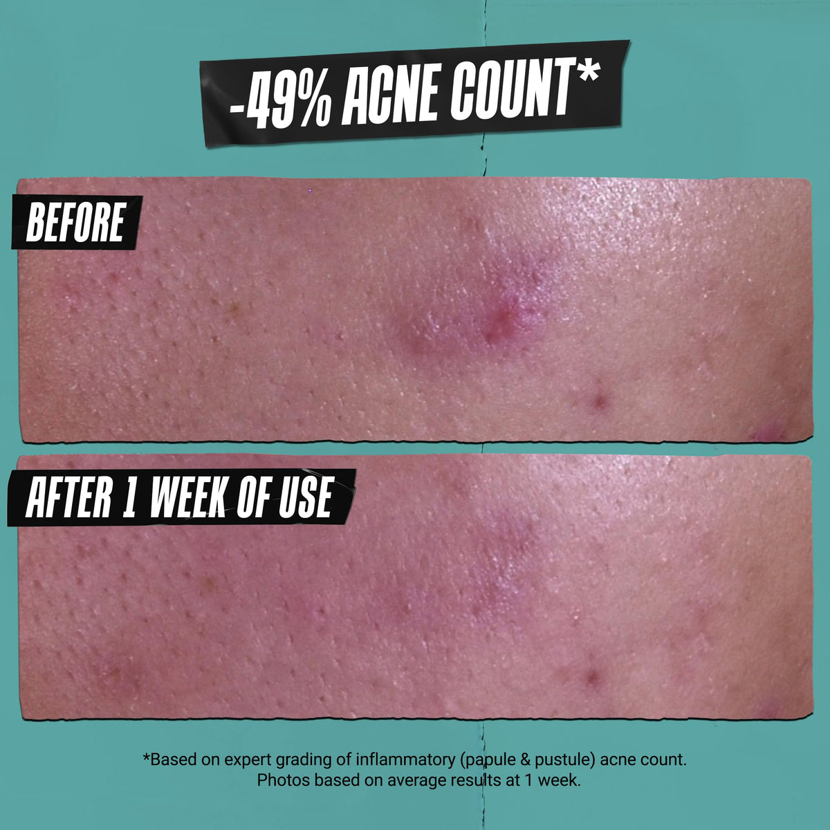 Kiehl's paste applied as a spot mask to cheek for targeted care