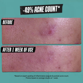 Kiehl's paste applied as a spot mask to cheek for targeted care