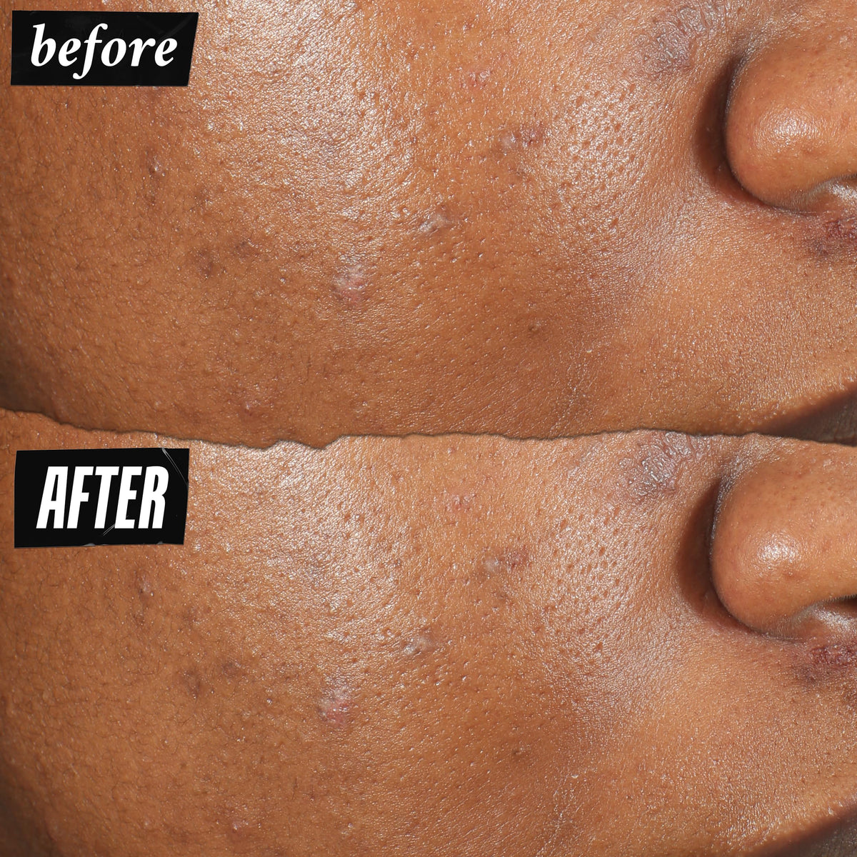 Kiehl's clear dry film on skin close-up showing invisible spot coverage benefit