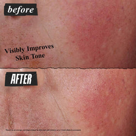 Kiehl's fingertip applying cream demonstrating soothing hydration
