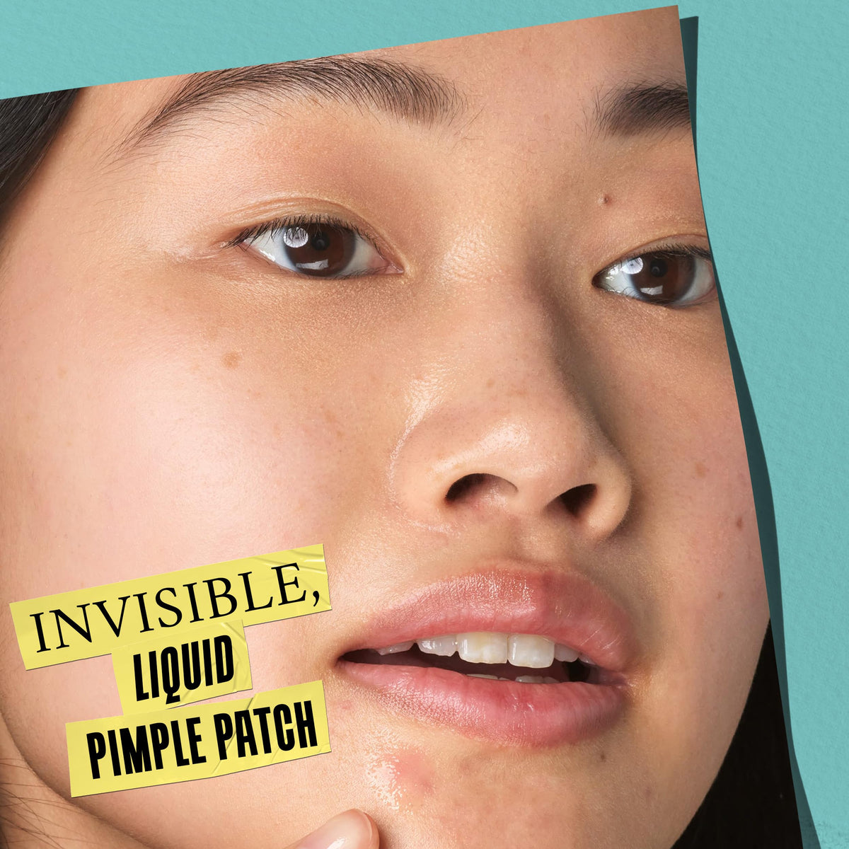Kiehl's being applied to a cheek to treat a pimple and reduce size