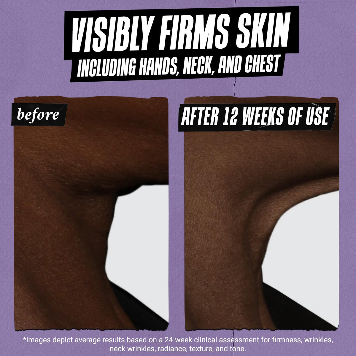 Kiehl's label close-up showing active list, supports ingredient transparency