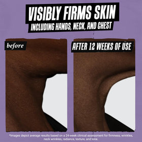 Kiehl's label close-up showing active list, supports ingredient transparency