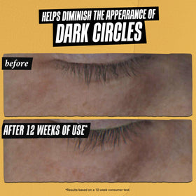 Kiehl's serum being applied with fingertip, demonstrating gentle under-eye patting benefit
