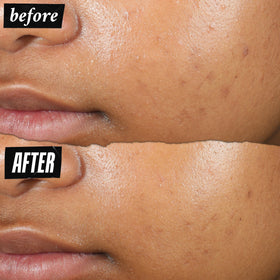 Kiehl's serum texture revealing lightweight formula for quick absorption