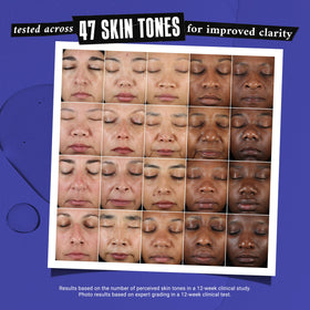 Kiehl's applied to cheek in demo illustrating targeted spot treatment use