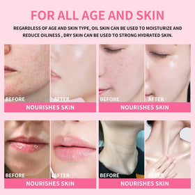 KIMUSE swiped along neck and jawline to hydrate and improve skin texture