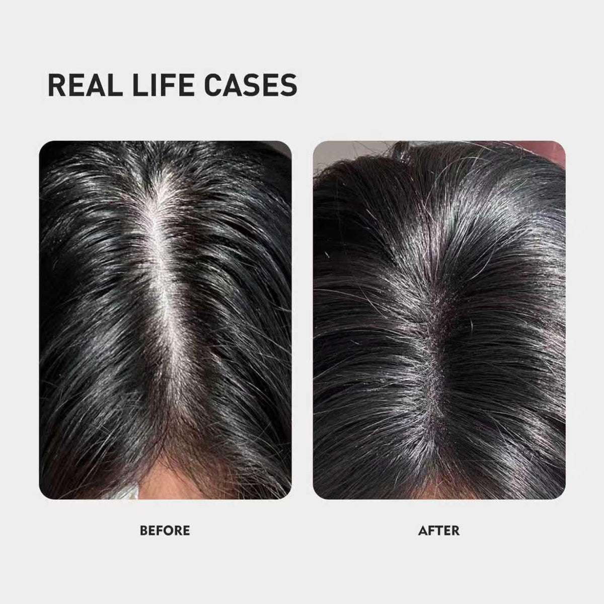 KINTOR texture drop on scalp showing fast-absorbing, non-greasy finish benefit