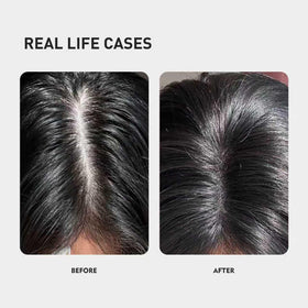 KINTOR texture drop on scalp showing fast-absorbing, non-greasy finish benefit