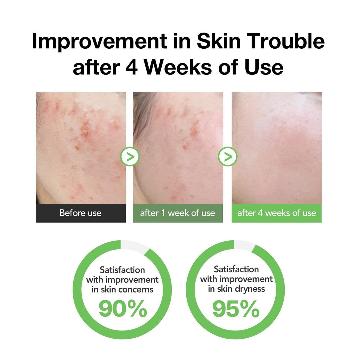 KIOSKIN applied on hand demonstrating fast absorption and non-greasy finish