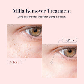 Kisinly serum dropper texture close-up highlighting fast-absorbing clarity