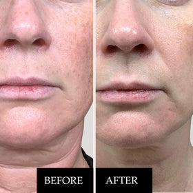 arrangement of vitamin C and ferulic acid visuals illustrating Kleem Organics antioxidant support