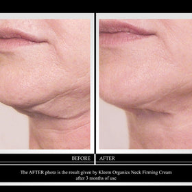 Kleem Organics cream texture close-up illustrating smooth absorption