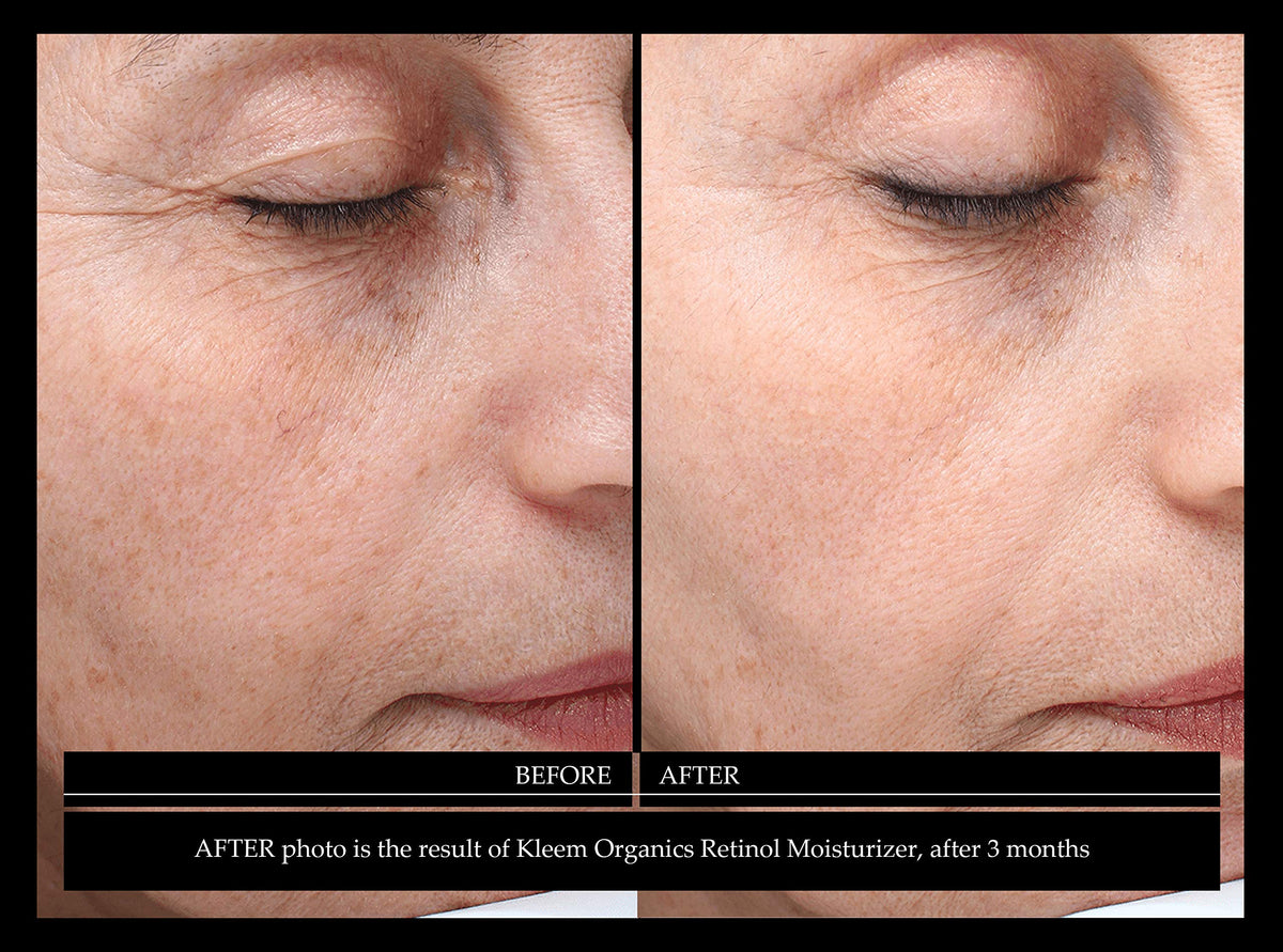 Kleem Organics application on model showing smooth absorption and glow