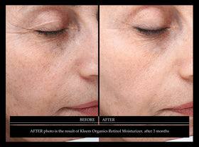 Kleem Organics application on model showing smooth absorption and glow