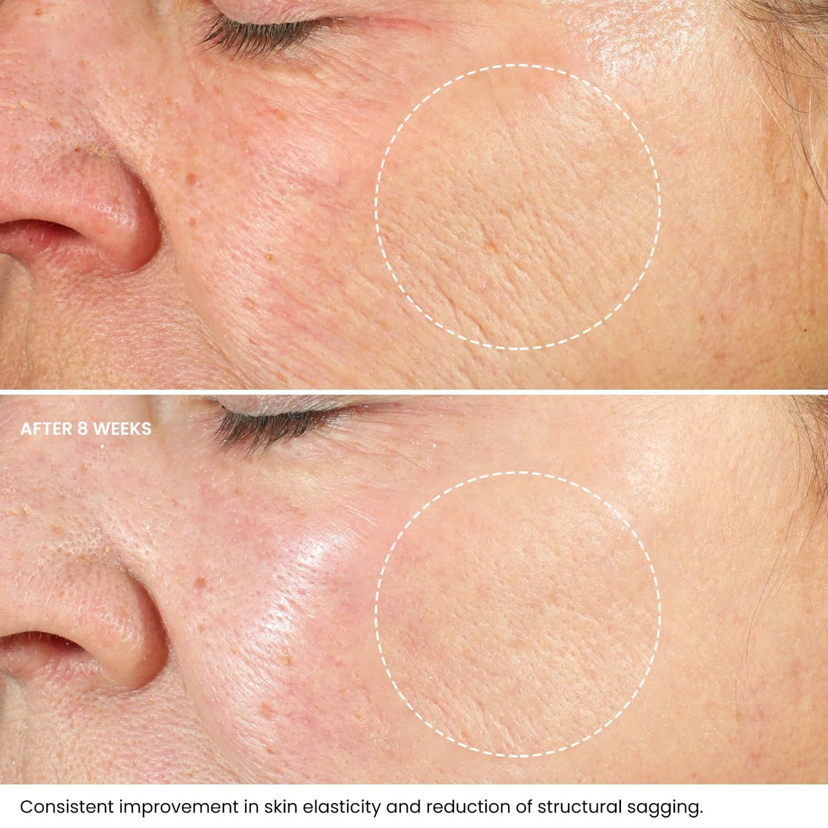 Kleem Organics ingredients visual with hyaluronic acid and vitamin E emphasis