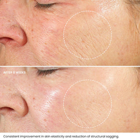 Kleem Organics ingredients visual with hyaluronic acid and vitamin E emphasis