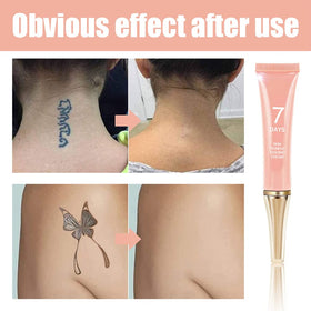 KlsyChry being applied to forearm showing gentle, painless method benefit