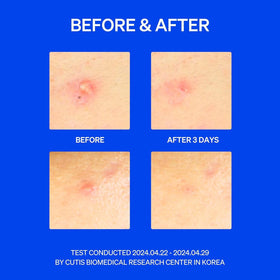 KNEMO patch on face demonstrating discreet wear under makeup