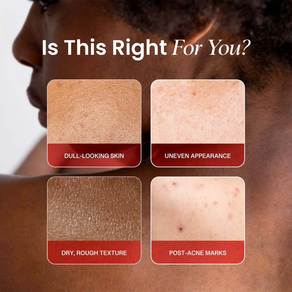 Koji White lotion texture droplet on hand, shows lightweight moisturizing feel