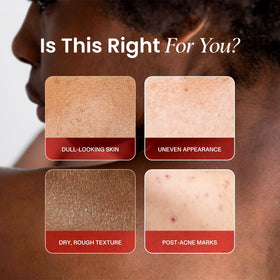 Koji White lotion texture droplet on hand, shows lightweight moisturizing feel