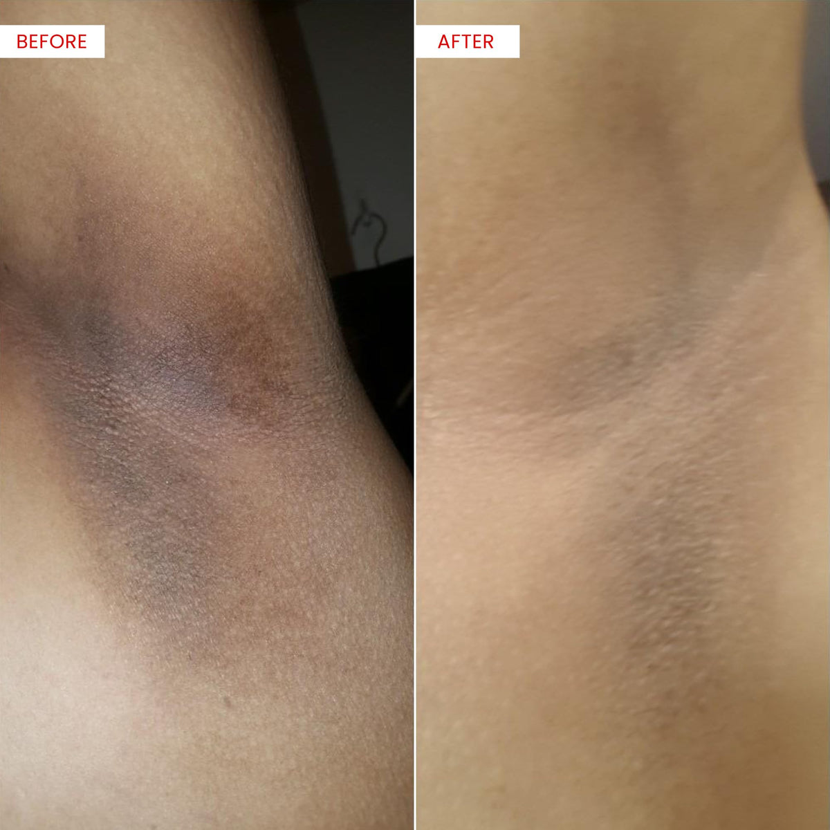 Koji White serum absorbing into skin showing fast-drying comfort