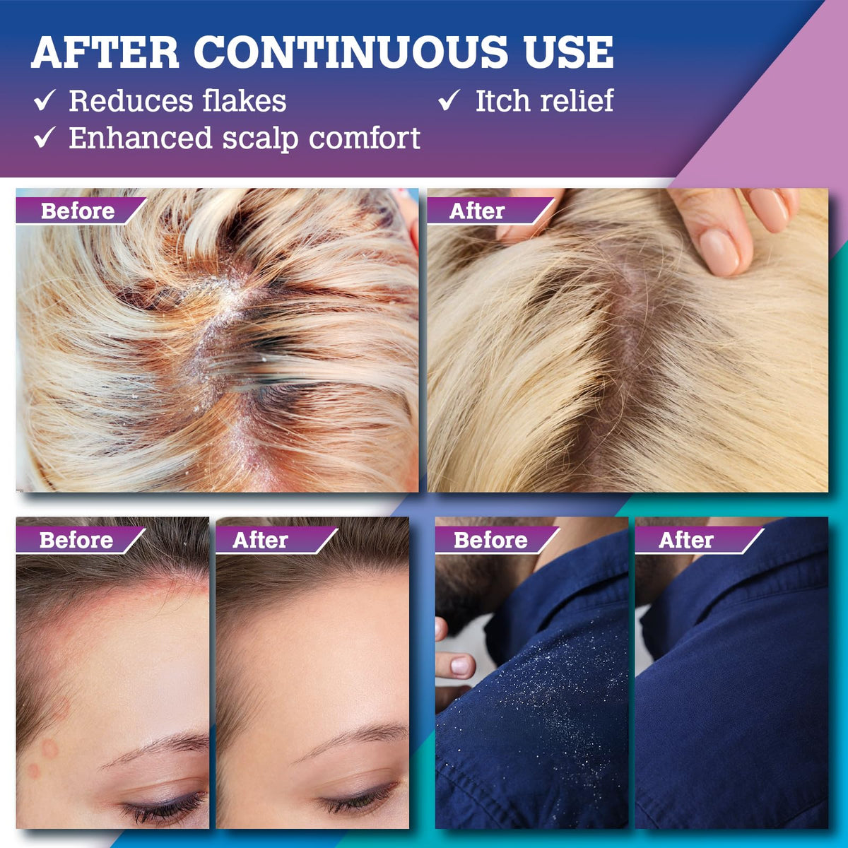 KOPA HAIKU scalp massage in-use image demonstrating effective application and exfoliating action