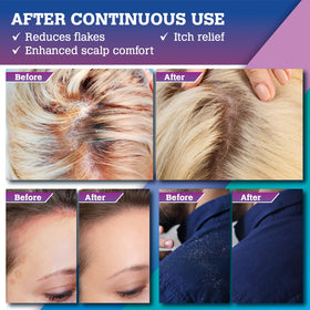 KOPA HAIKU scalp massage in-use image demonstrating effective application and exfoliating action