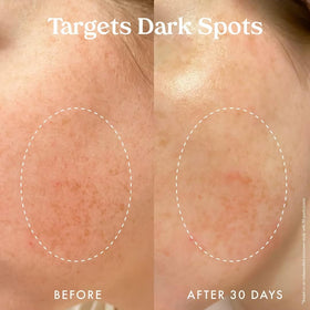 Starfruit ingredient visual with Kopari branding, signaling natural brightening support