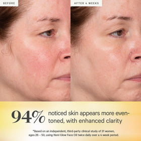 KORA Organics oil texture on skin, demonstrating lightweight absorption and glow benefit