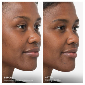 KORRES dropper dispensing serum onto finger, demonstrates controlled application benefit