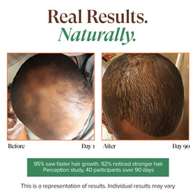 KREYÒL ESSENCE hot oil treatment wrapped with cap to boost penetration