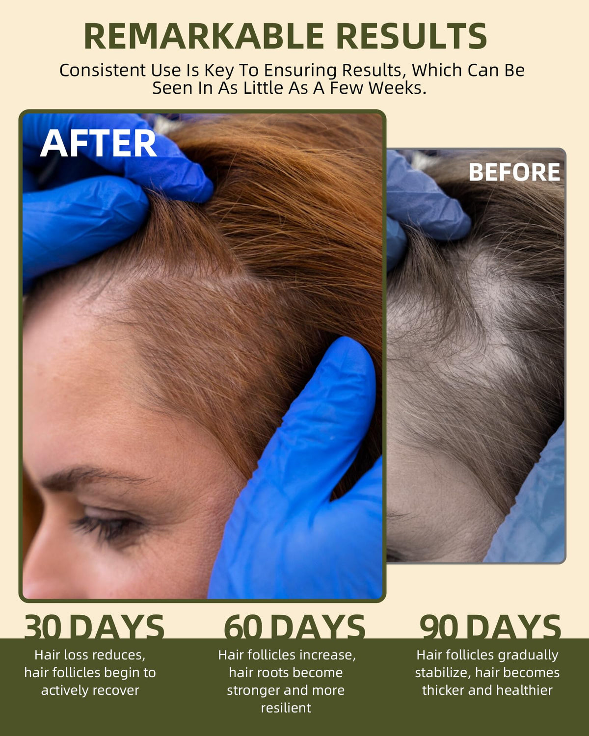 Ktintar oil applied to scalp demonstrating nourishment and scalp care
