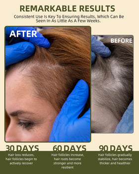Ktintar oil applied to scalp demonstrating nourishment and scalp care