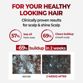 KUNDAL shampoo texture close-up showing creamy consistency and moisturizing benefit