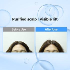 KUNDAL creamy foam on hand illustrating gentle lather and lightweight hydration