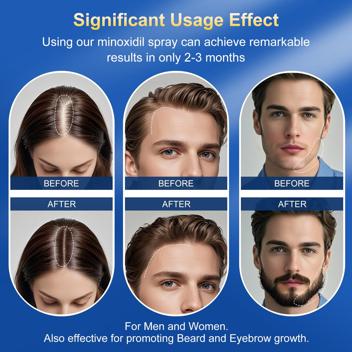 Kweqdsd applied to beard patch illustrating targeted regrowth support
